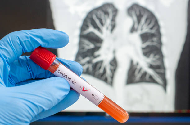 test coronavirus