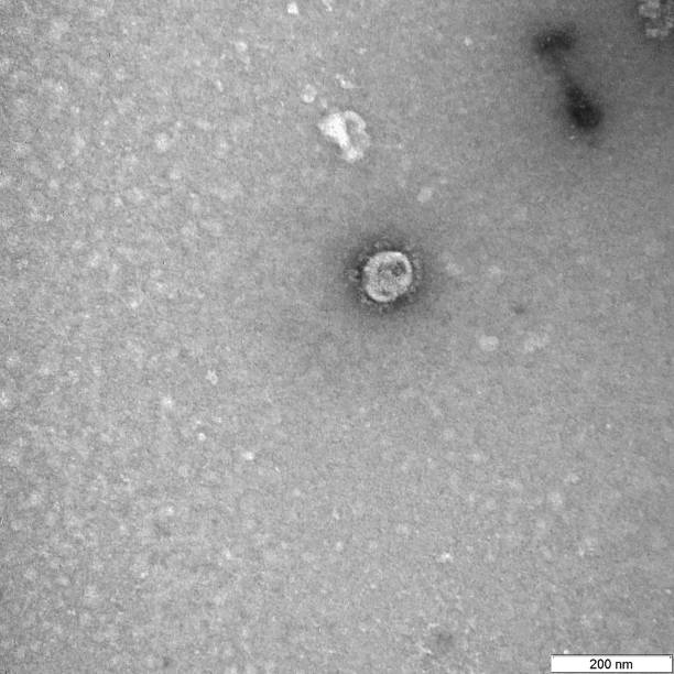 Imagen del coronavirus en microscopio