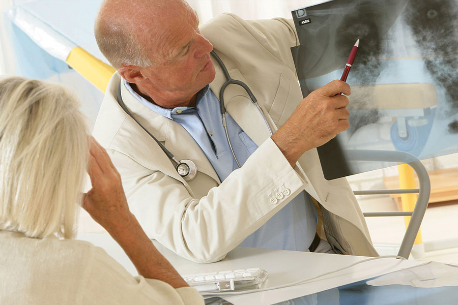cáncer de pulmón