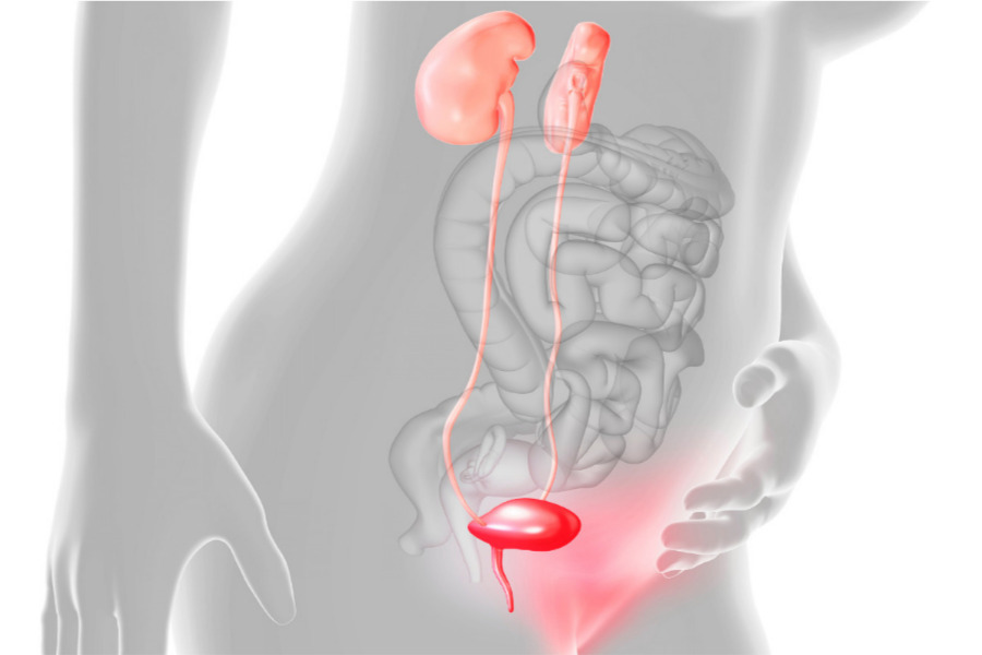 Infecciones urinarias